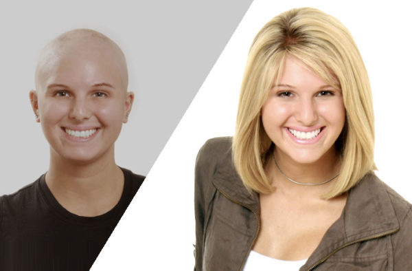 chemotherapy wig model